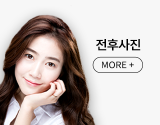 에스탑의원 화곡점 화곡필러 화곡동필러 화곡동보톡스 화곡보톡스 전후사진