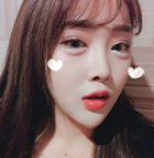 에스탑의원 화곡점 화곡필러 화곡동필러 화곡동보톡스 화곡보톡스 리얼리뷰
