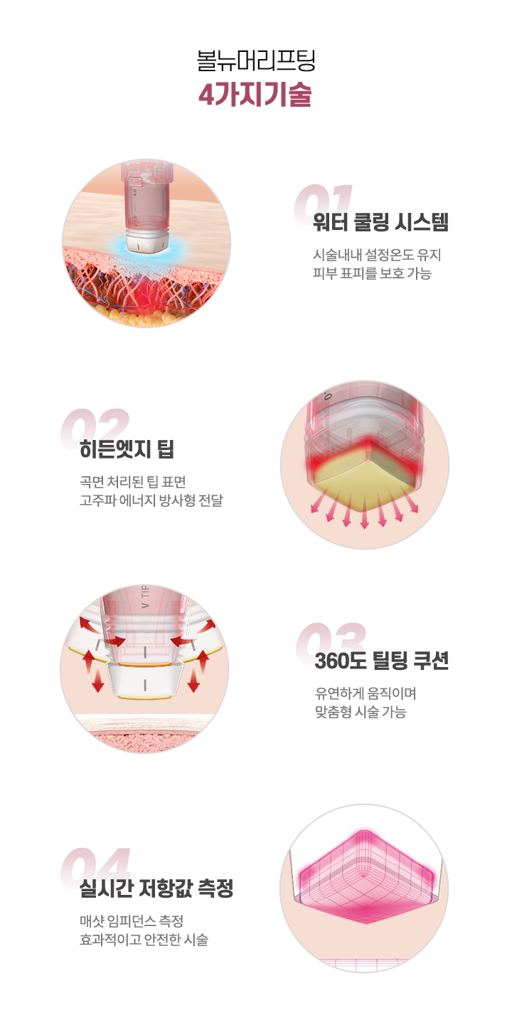 올리지오란
