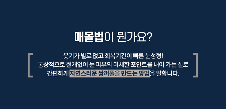 매몰법이 뭔가요
