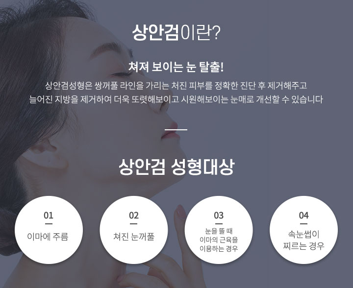상안검이란/상안검 성형대상