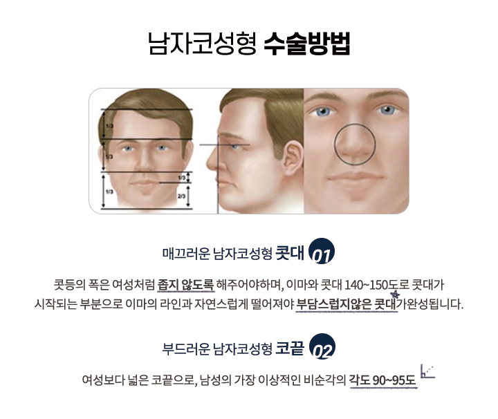 남자코성형 수술방법