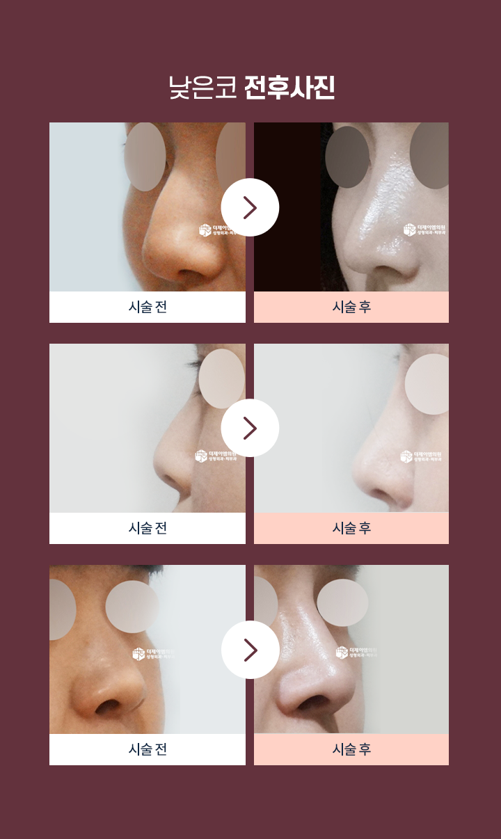 낮은코