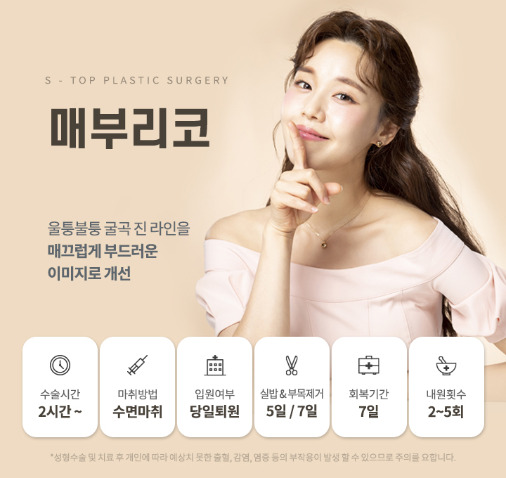 매부리코
