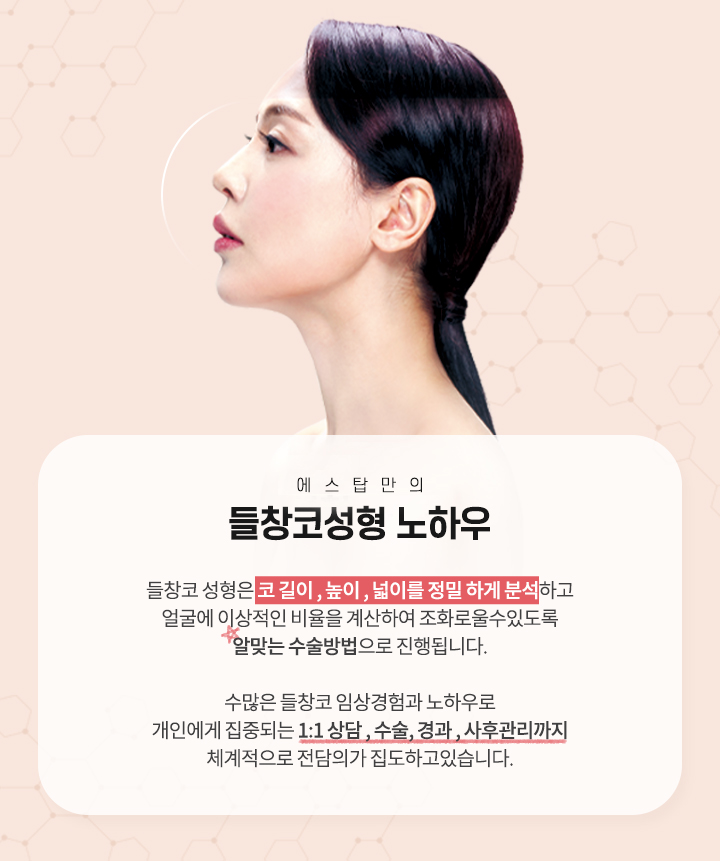 들창코성형 노하우