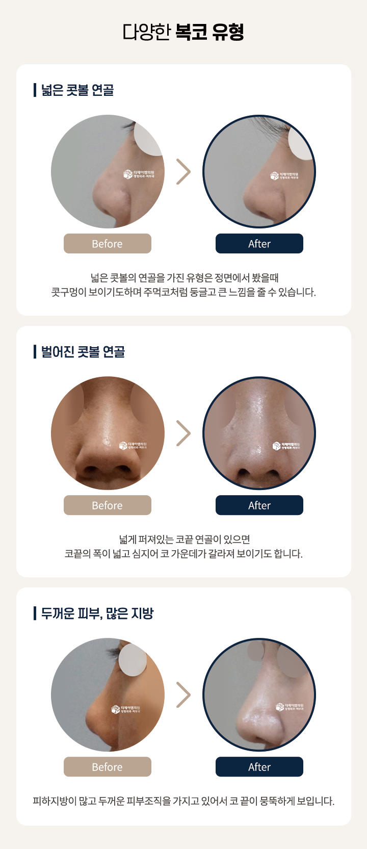 다양한 복코유형