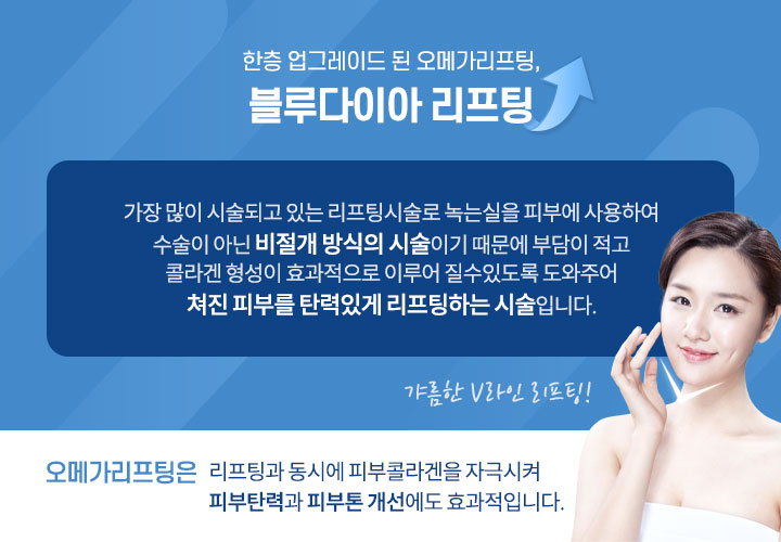 블루다이아리프팅