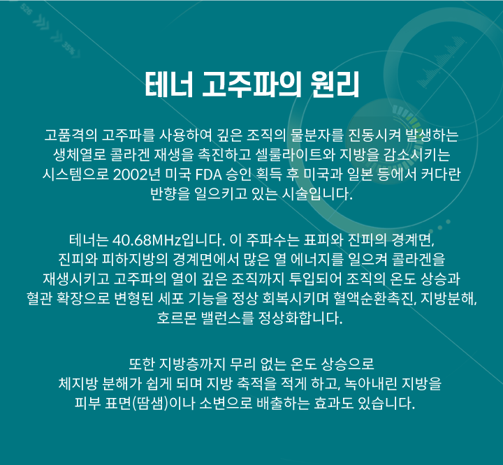테너고주파원리