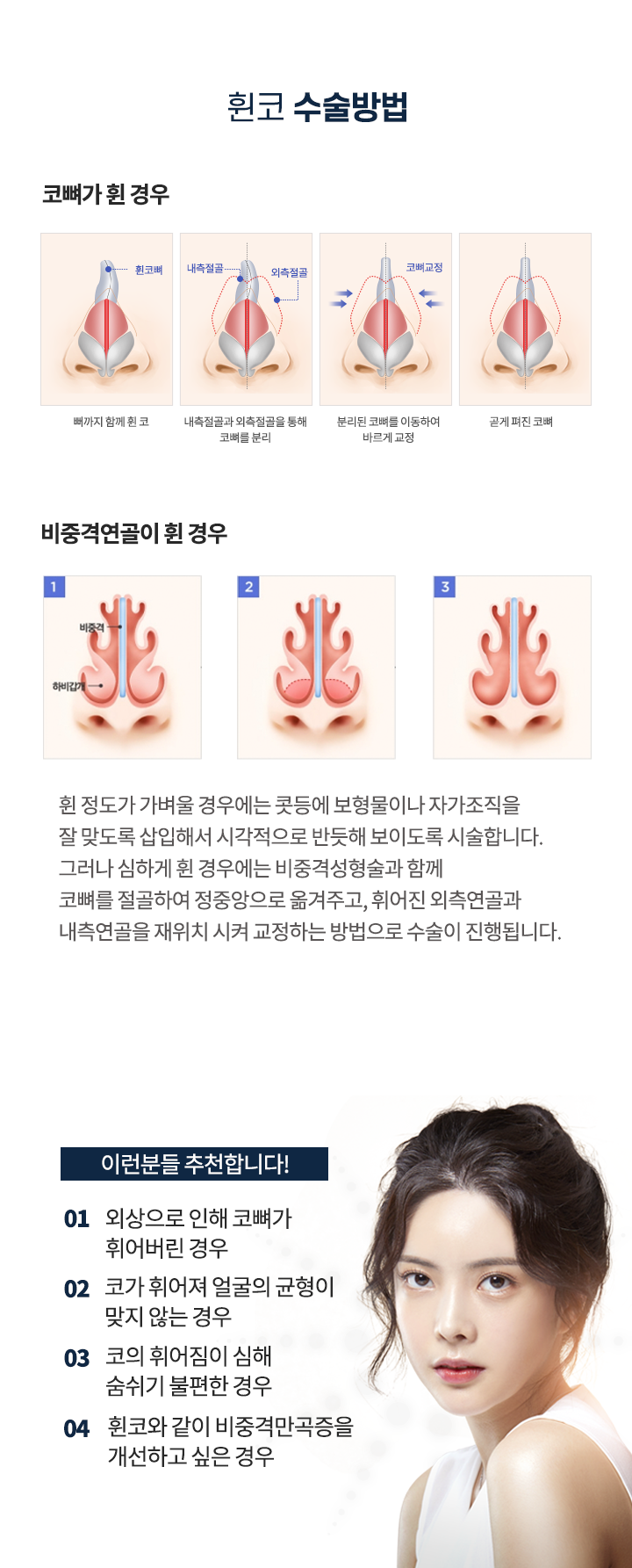 휜코