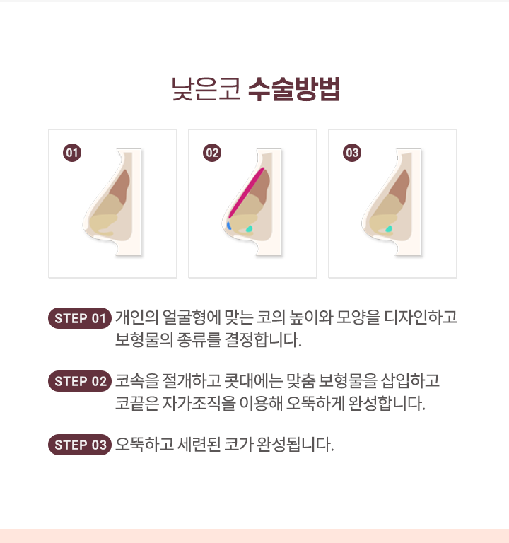낮은코