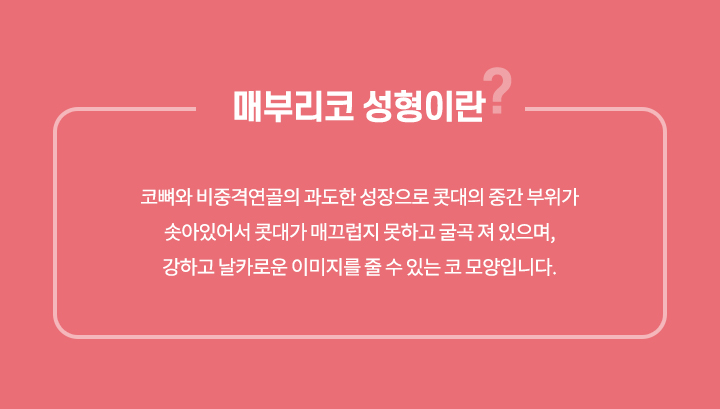 매부리코