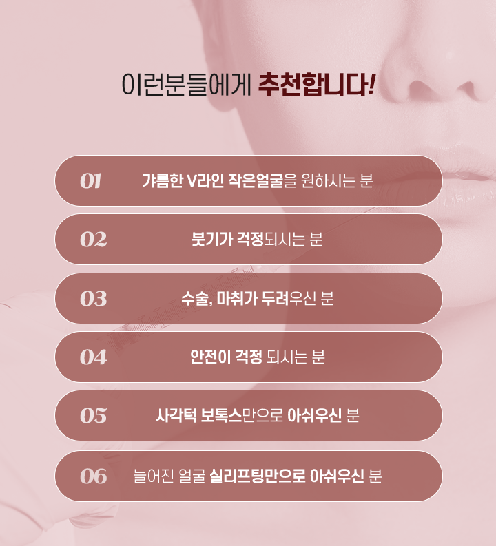 에스탑 추천
