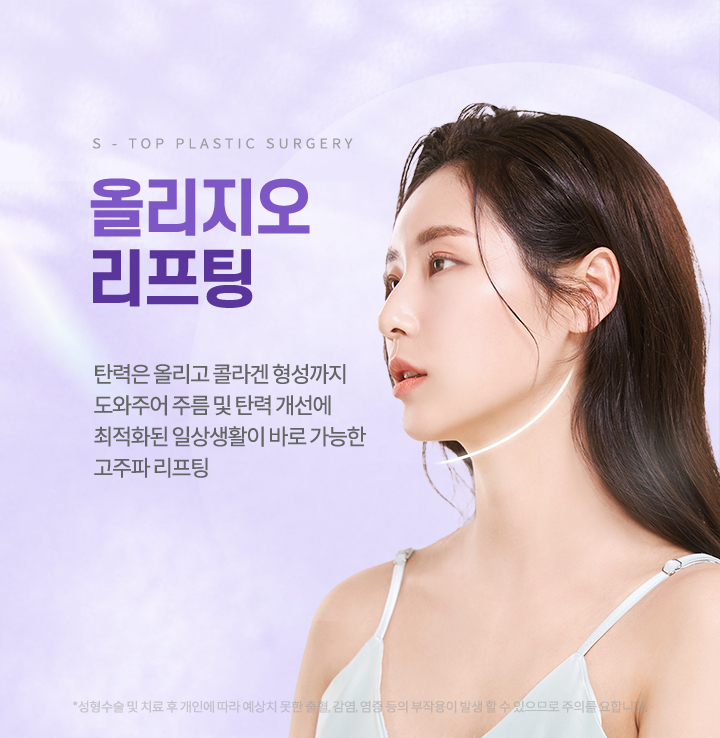 에스탑 올리지오