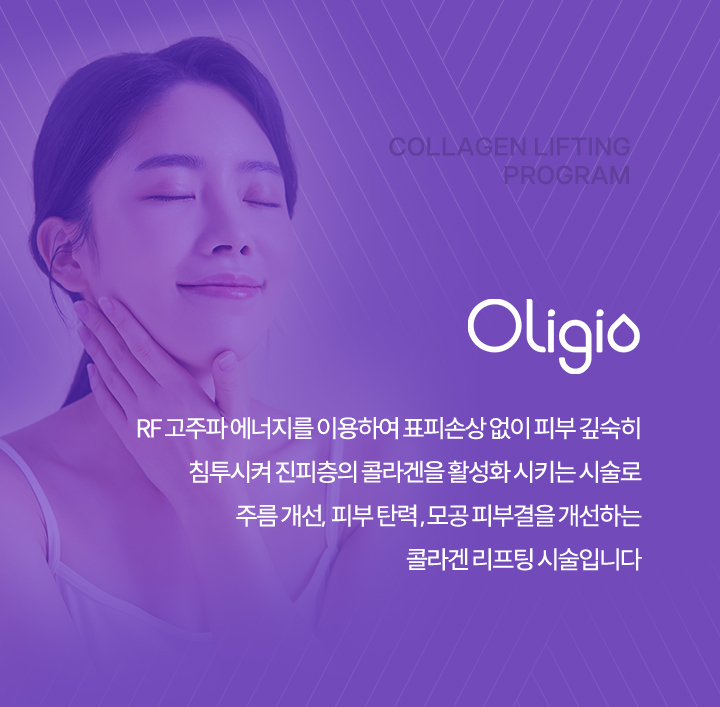 올리지오란