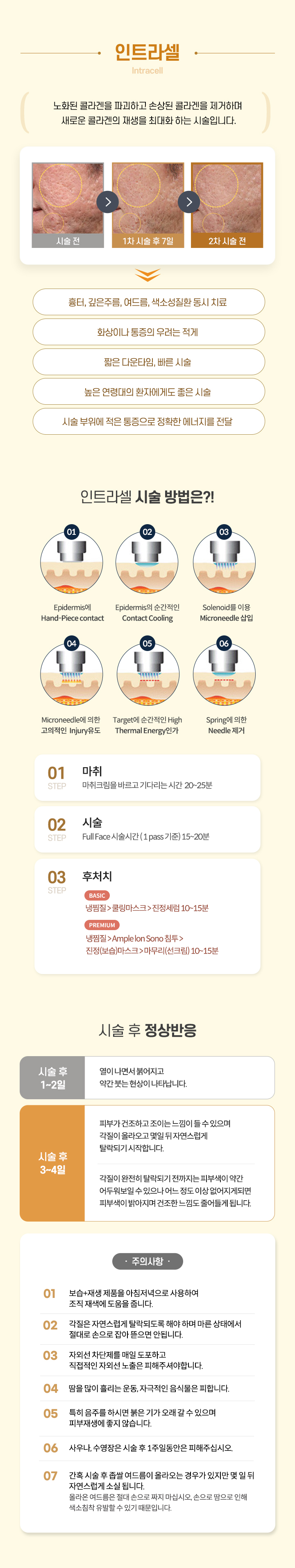인트라셀